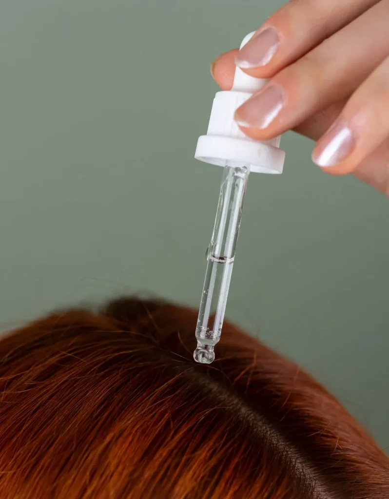 Saç derisine damlalıkla serum uygulaması